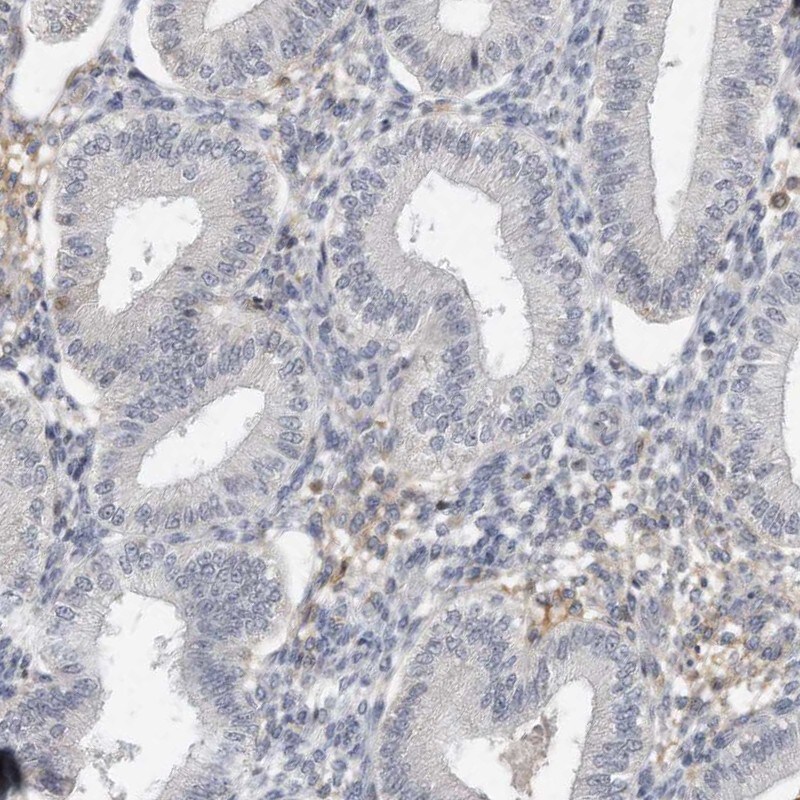 DDX43 Antibody - BSA Free Immunohistochemistry-Paraffin: DDX43 Antibody [NBP1-85419]