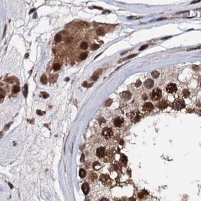 CSTF3 Antibody - BSA Free Immunohistochemistry-Paraffin: CSTF3 Antibody [NBP1-85427]