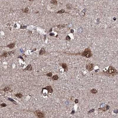 CSTF3 Antibody - BSA Free Immunohistochemistry-Paraffin: CSTF3 Antibody [NBP1-85427]