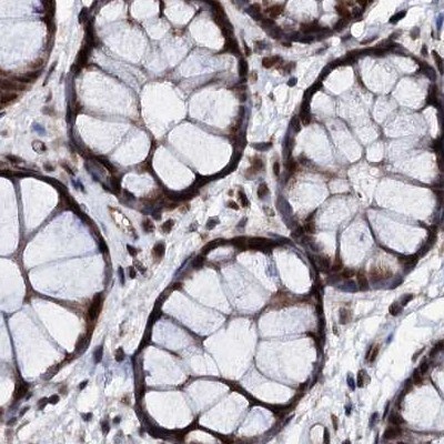 CSTF3 Antibody - BSA Free Immunohistochemistry-Paraffin: CSTF3 Antibody [NBP1-85427]