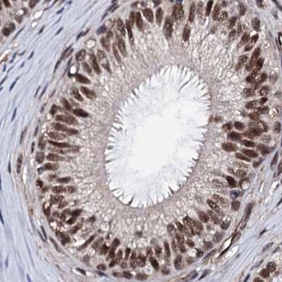 CSTF3 Antibody - BSA Free Immunohistochemistry-Paraffin: CSTF3 Antibody [NBP1-85427]