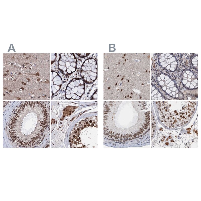 CSTF3 Antibody - BSA Free Immunohistochemistry-Paraffin: CSTF3 Antibody [NBP1-85427]