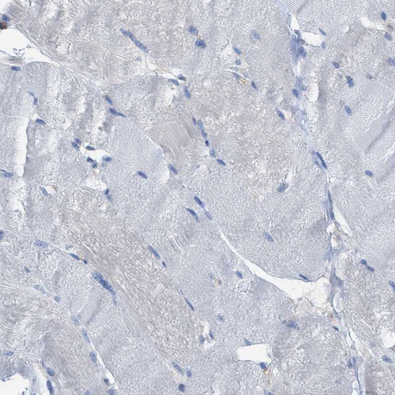 Cystatin B/Stefin B Antibody - BSA Free Immunohistochemistry-Paraffin: Cystatin B/Stefin B Antibody [NBP1-85430]