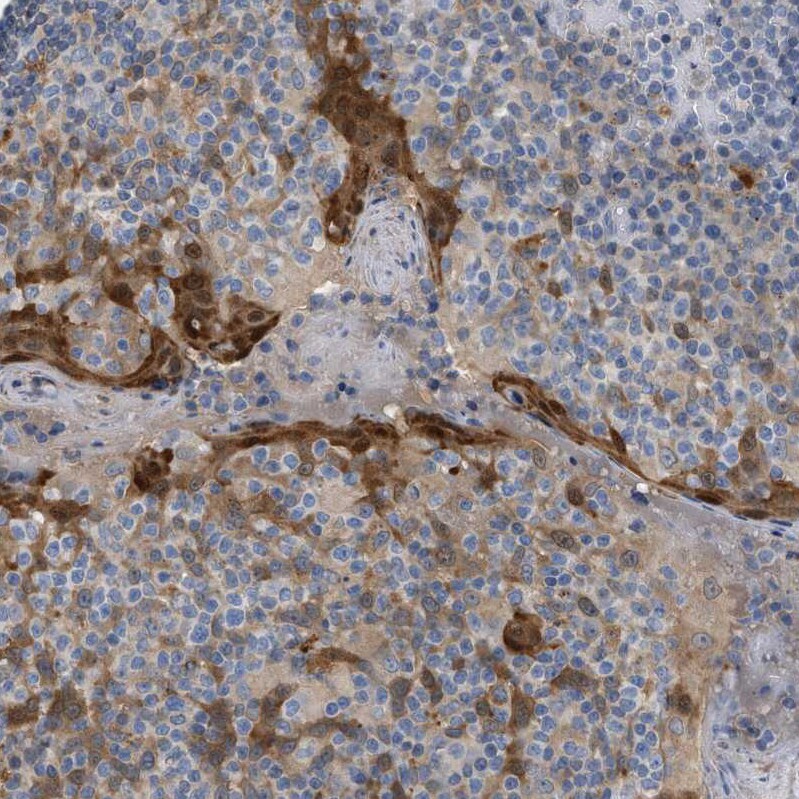 Cystatin B/Stefin B Antibody - BSA Free Immunohistochemistry-Paraffin: Cystatin B/Stefin B Antibody [NBP1-85430]
