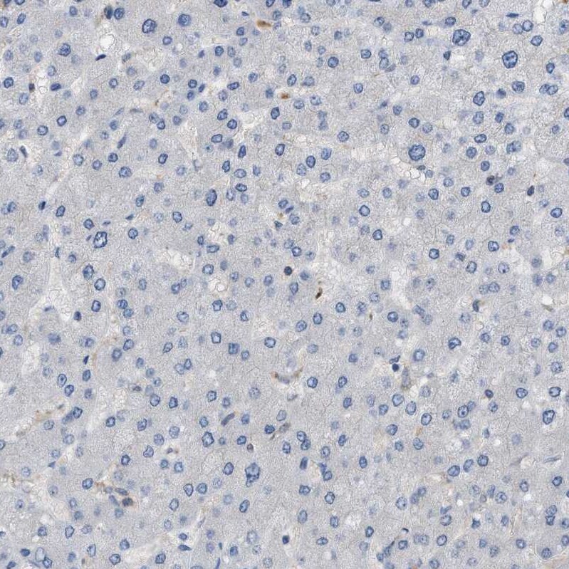 Cystatin B/Stefin B Antibody - BSA Free Immunohistochemistry-Paraffin: Cystatin B/Stefin B Antibody [NBP1-85430]