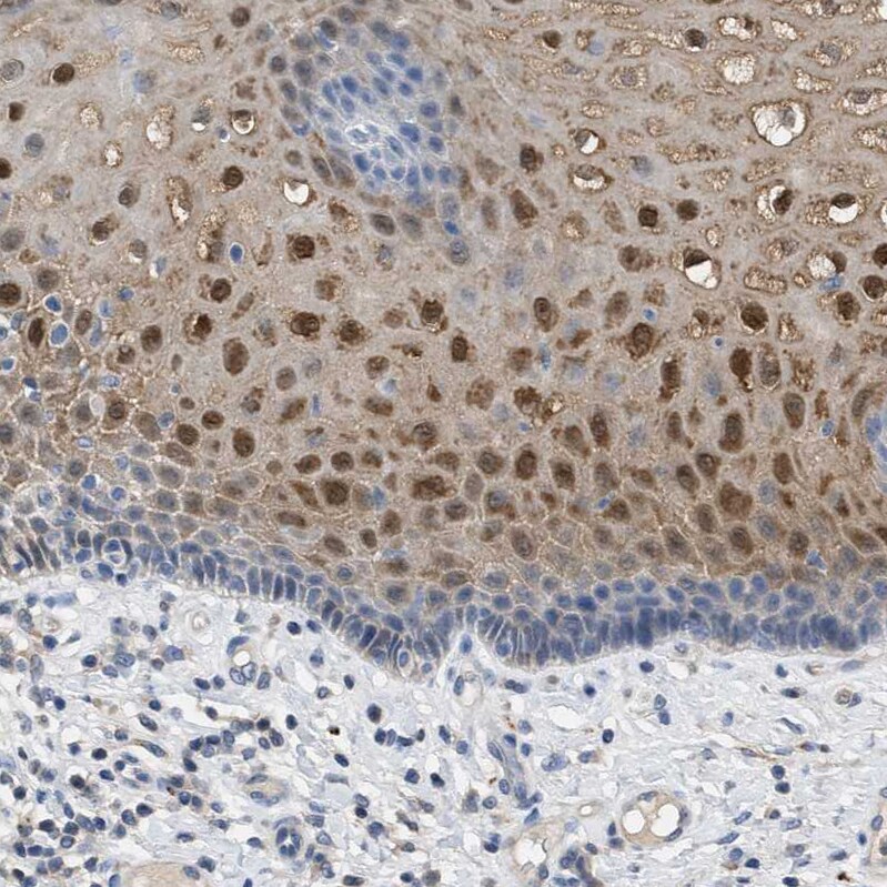 Cystatin B/Stefin B Antibody - BSA Free Immunohistochemistry-Paraffin: Cystatin B/Stefin B Antibody [NBP1-85430]