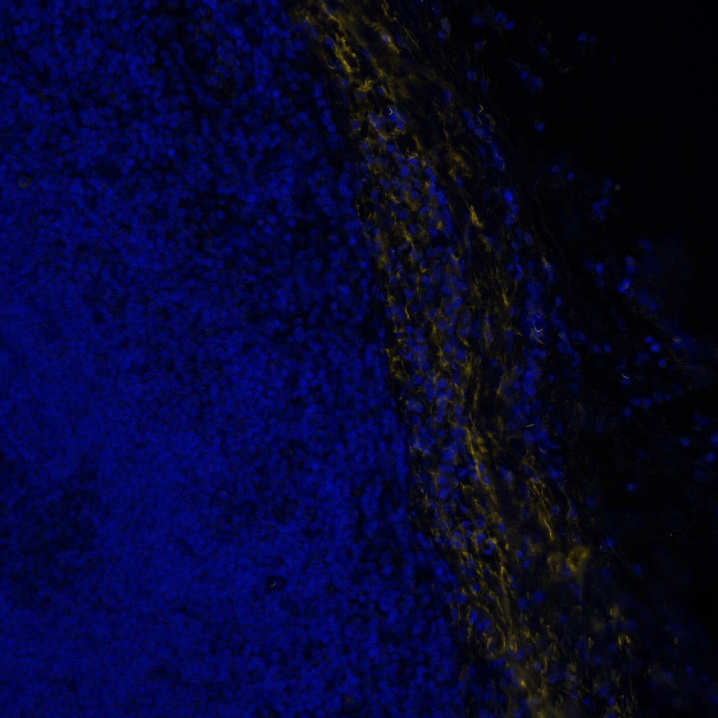 Versican Antibody - BSA Free