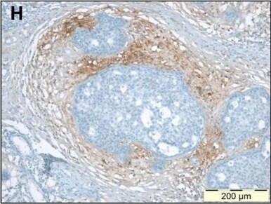 Versican Antibody