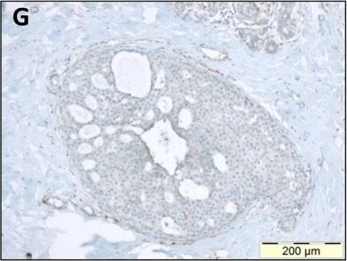Versican Antibody