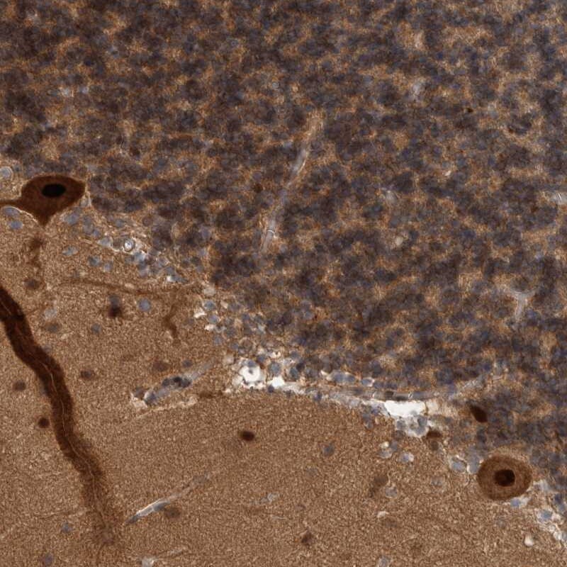 COP9 Antibody - BSA Free Immunohistochemistry-Paraffin: COP9 Antibody [NBP1-85435]