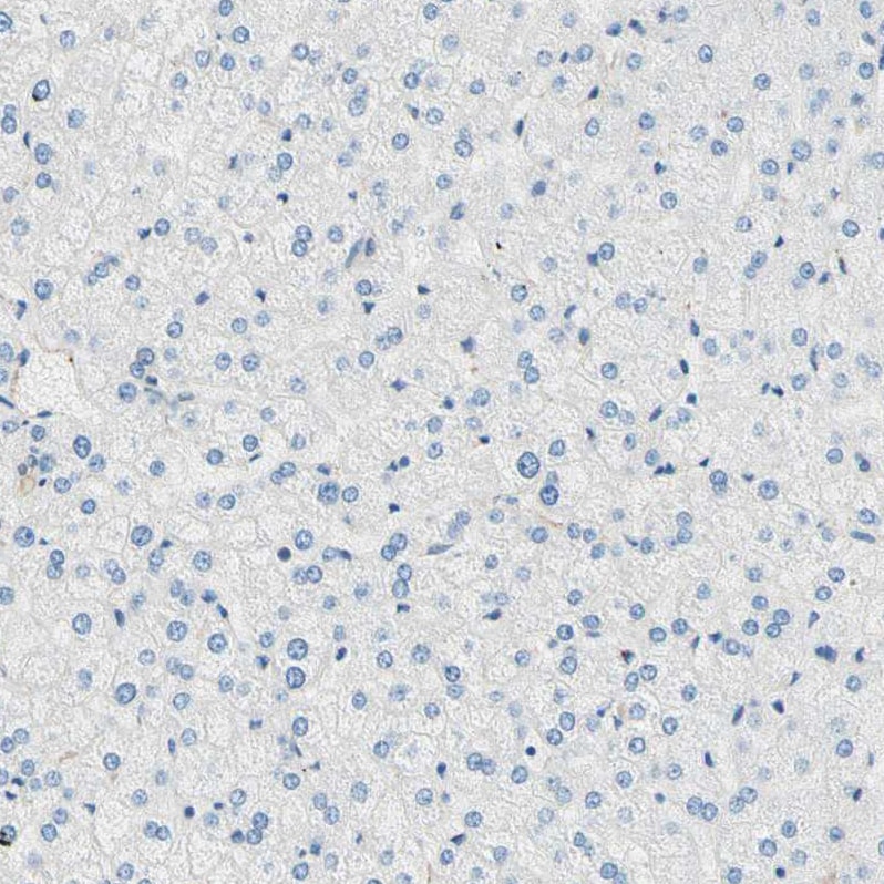 CRMP4 Antibody - BSA Free Immunohistochemistry-Paraffin: CRMP4 Antibody [NBP1-85447]