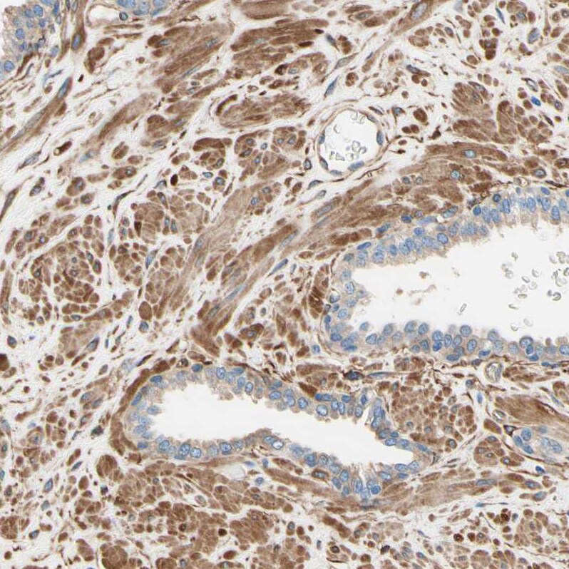 CRMP4 Antibody - BSA Free Immunohistochemistry-Paraffin: CRMP4 Antibody [NBP1-85447]