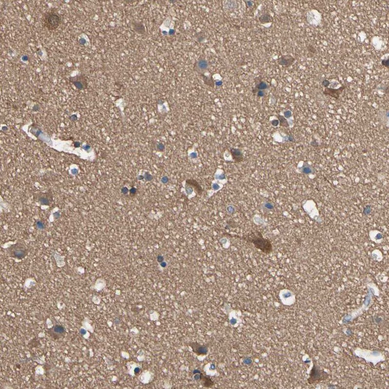 CRMP4 Antibody - BSA Free Immunohistochemistry-Paraffin: CRMP4 Antibody [NBP1-85447]