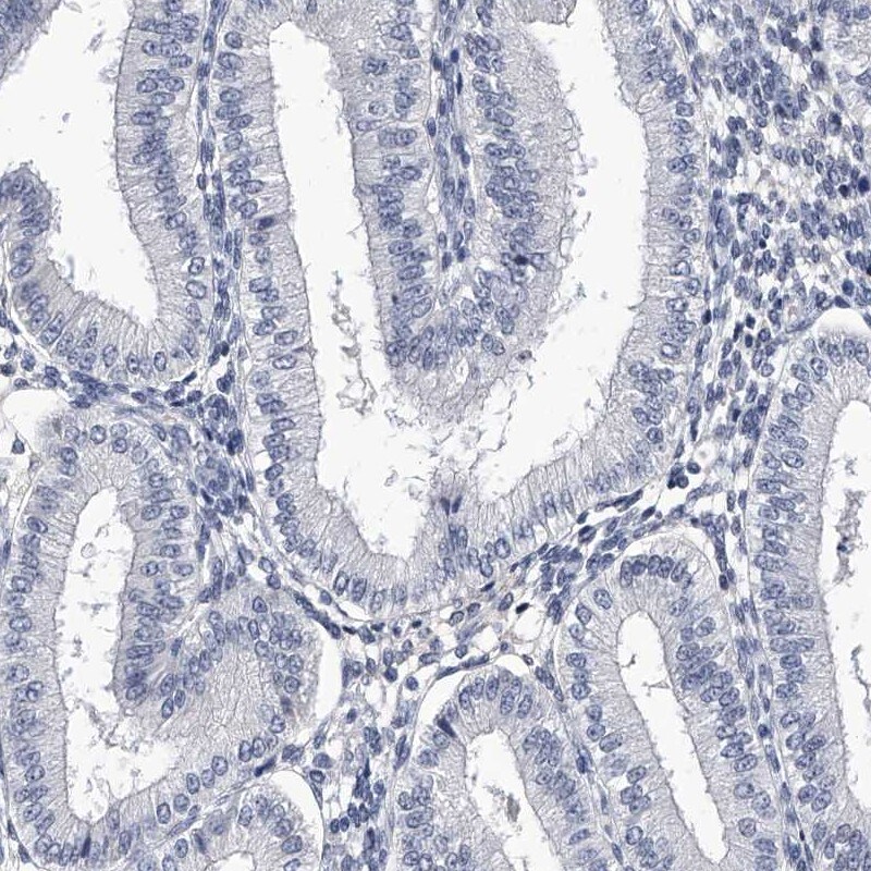 CRISP-2 Antibody - BSA Free Immunohistochemistry: CRISP-2 Antibody - BSA Free [NBP1-85452]