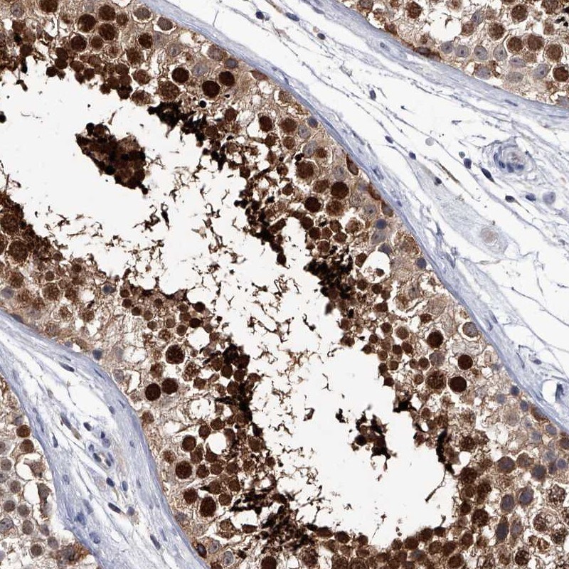 CRISP-2 Antibody - BSA Free Immunohistochemistry: CRISP-2 Antibody - BSA Free [NBP1-85452]