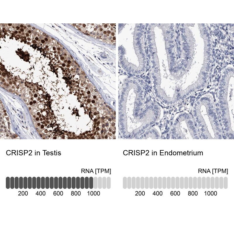 CRISP-2 Antibody - BSA Free Immunohistochemistry: CRISP-2 Antibody - BSA Free [NBP1-85452]