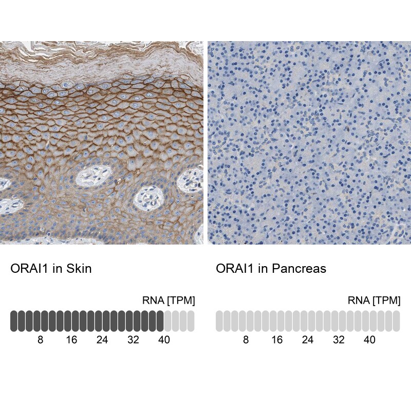 Orai1 Antibody - BSA Free Immunohistochemistry-Paraffin: Orai1 Antibody [NBP1-85463]