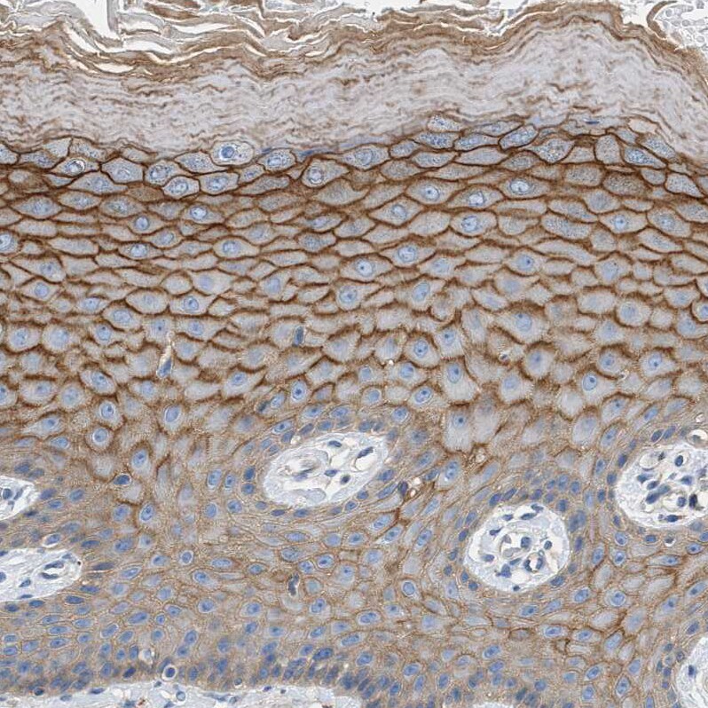 Orai1 Antibody - BSA Free Immunohistochemistry-Paraffin: Orai1 Antibody [NBP1-85463]