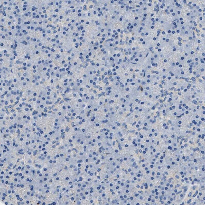 Orai1 Antibody - BSA Free Immunohistochemistry-Paraffin: Orai1 Antibody [NBP1-85463]