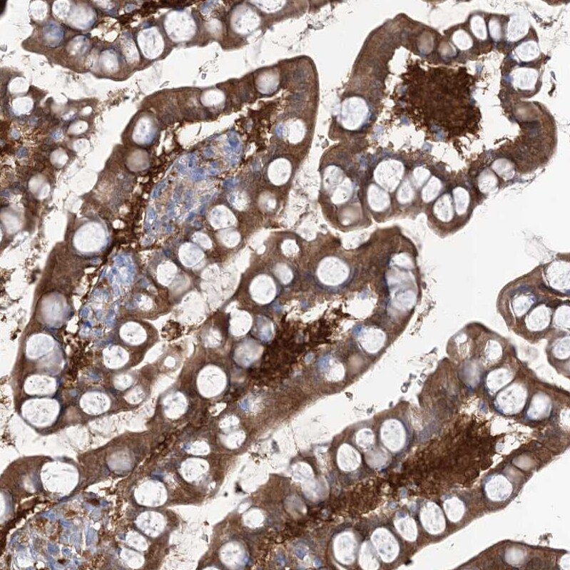 RBP2 Antibody - BSA Free Immunohistochemistry-Paraffin: RBP2 Antibody [NBP1-85464]