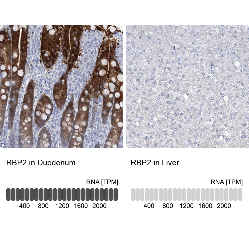 RBP2 Antibody - BSA Free Immunohistochemistry-Paraffin: RBP2 Antibody [NBP1-85464]
