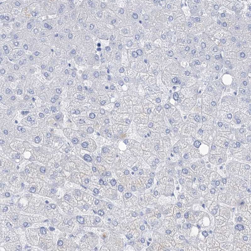 RBP2 Antibody - BSA Free Immunohistochemistry-Paraffin: RBP2 Antibody [NBP1-85464]