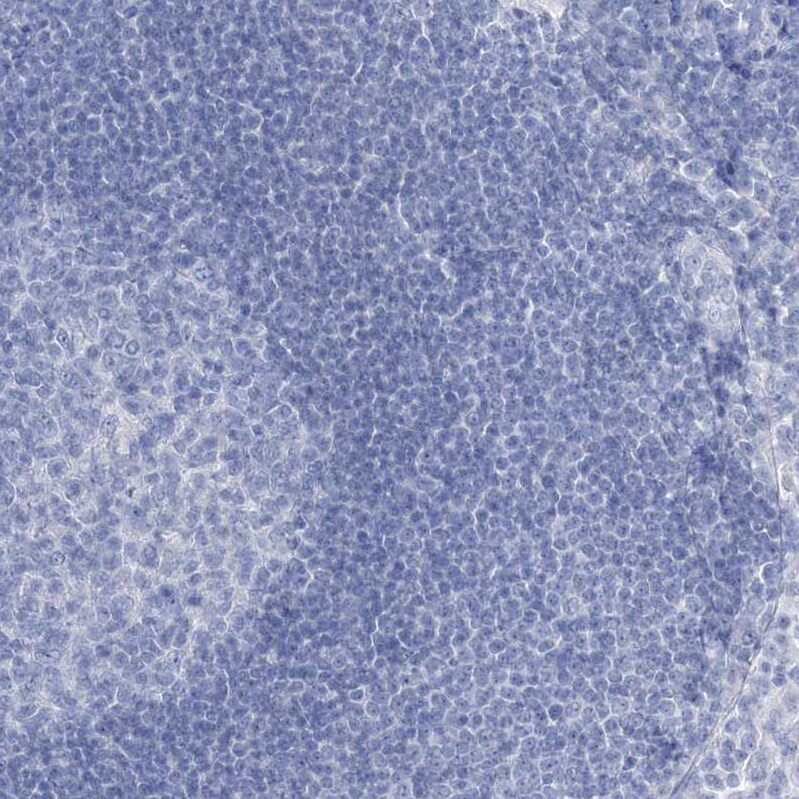 RBP2 Antibody - BSA Free Immunohistochemistry-Paraffin: RBP2 Antibody [NBP1-85464]