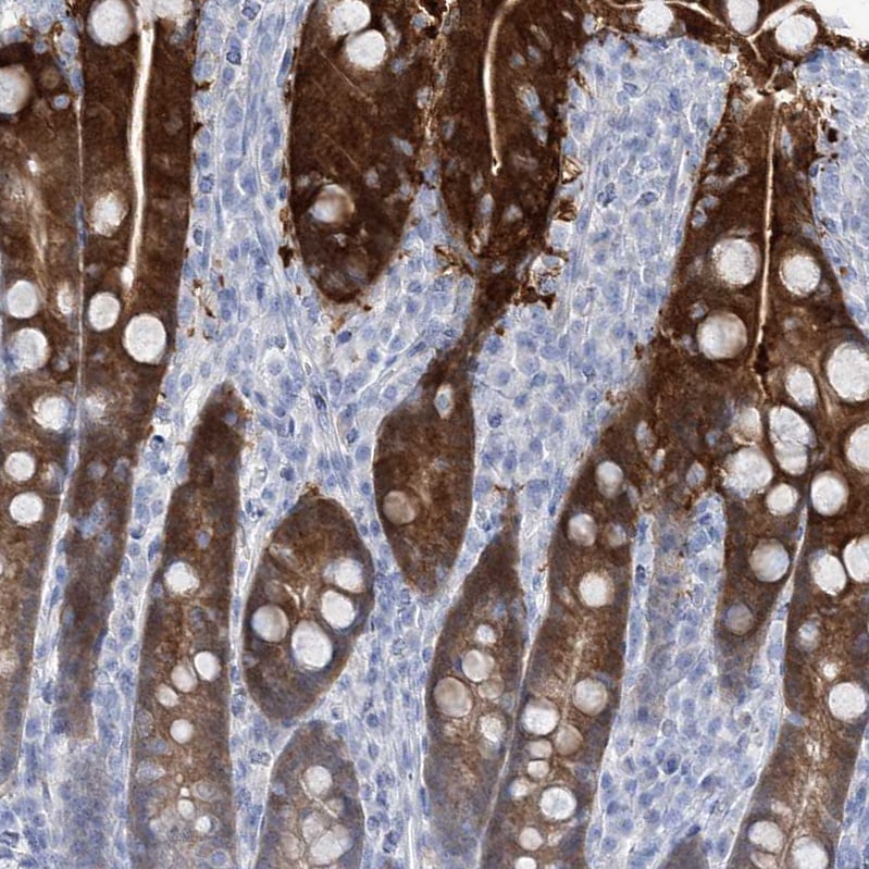 RBP2 Antibody - BSA Free Immunohistochemistry-Paraffin: RBP2 Antibody [NBP1-85464]