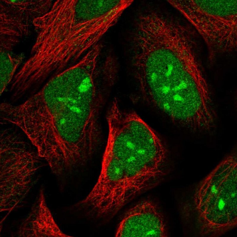 UBLCP1 Antibody - BSA Free Immunocytochemistry/ Immunofluorescence: UBLCP1 Antibody [NBP1-85468]