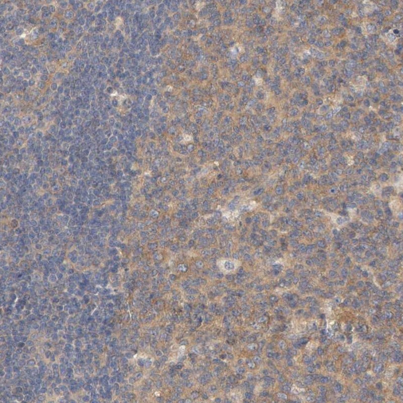 Carboxypeptidase B2/CPB2 Antibody - BSA Free Immunohistochemistry: Carboxypeptidase B2/CPB2 Antibody - BSA Free [NBP1-85469]