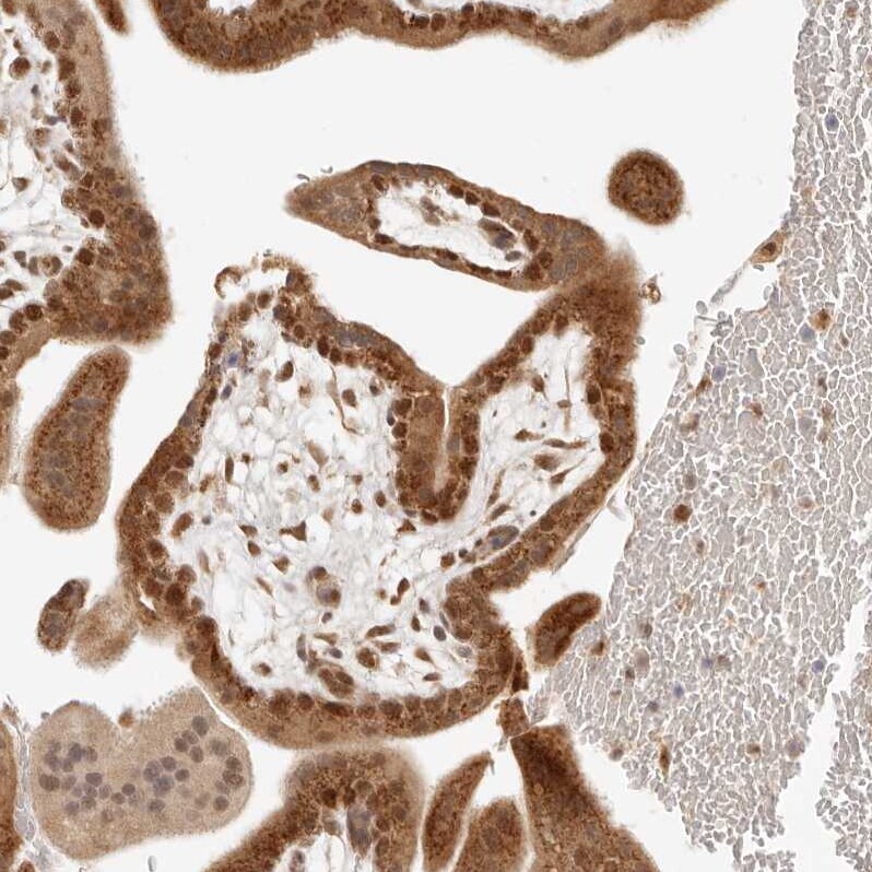 INTS11 Antibody - BSA Free Immunohistochemistry: INTS11 Antibody - BSA Free [NBP1-85474]