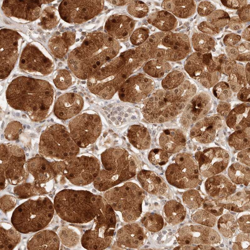 INTS11 Antibody - BSA Free Immunohistochemistry: INTS11 Antibody - BSA Free [NBP1-85474]