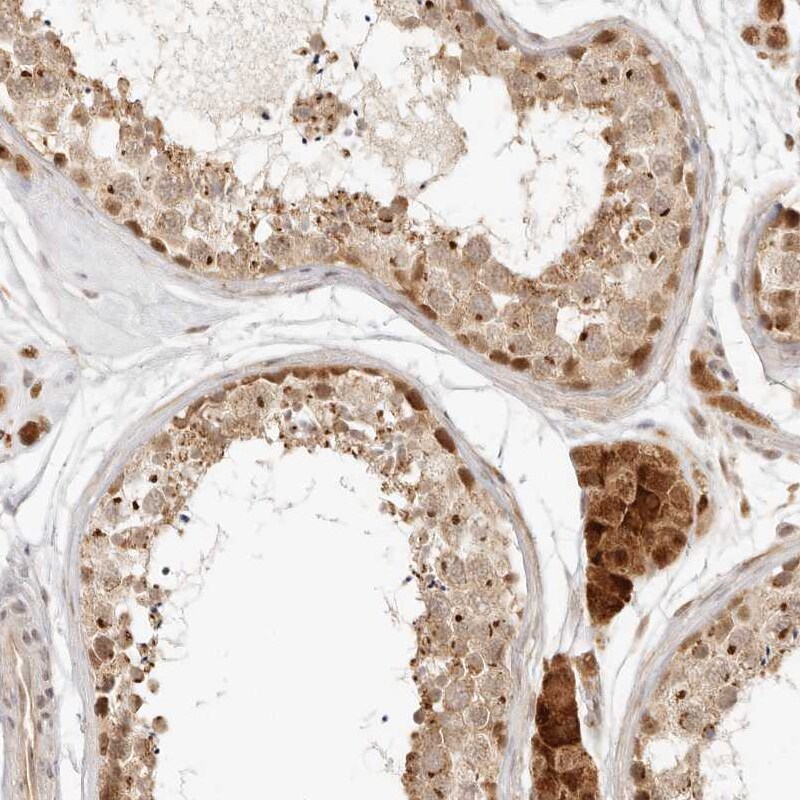 INTS11 Antibody - BSA Free Immunohistochemistry: INTS11 Antibody - BSA Free [NBP1-85474]