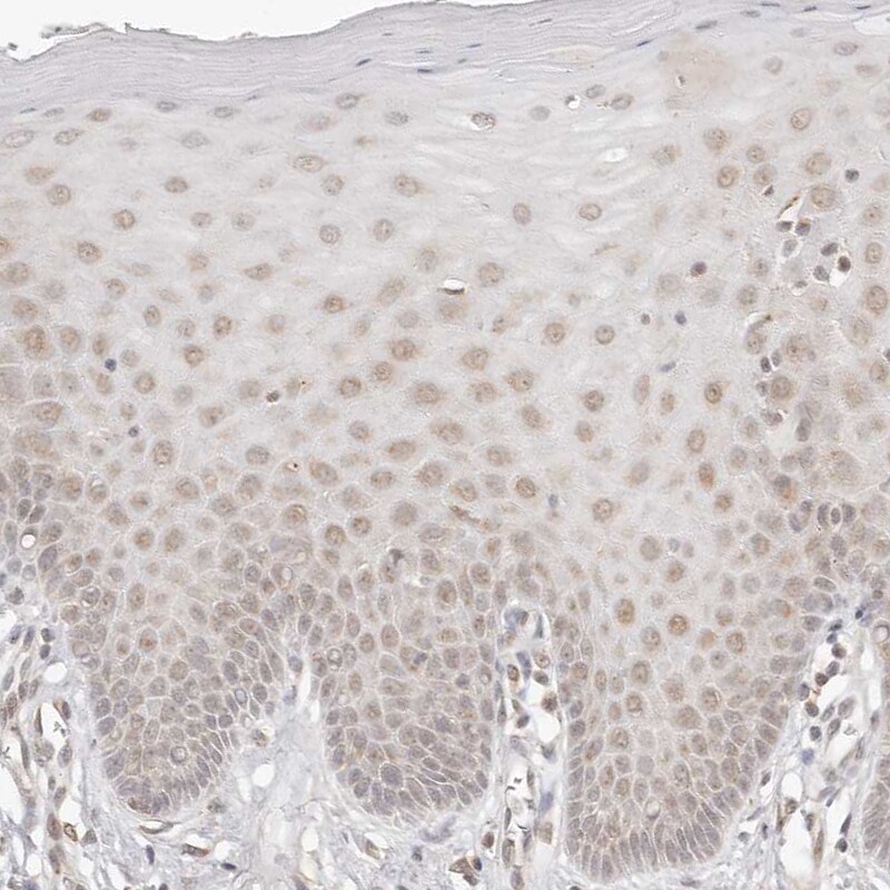 INTS11 Antibody - BSA Free Immunohistochemistry: INTS11 Antibody - BSA Free [NBP1-85474]
