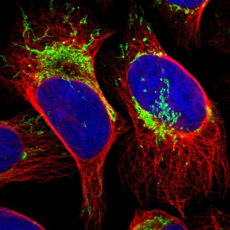 TBRG4 Antibody - BSA Free Immunocytochemistry/ Immunofluorescence: TBRG4 Antibody [NBP1-85478]