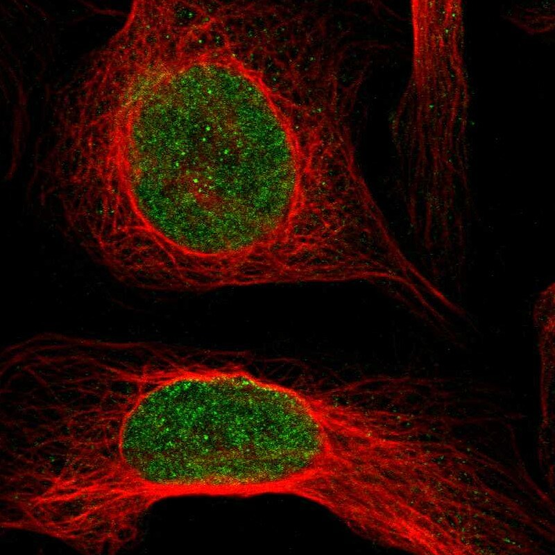 TIP60 Antibody - BSA Free Immunocytochemistry/ Immunofluorescence: TIP60 Antibody [NBP1-85482]