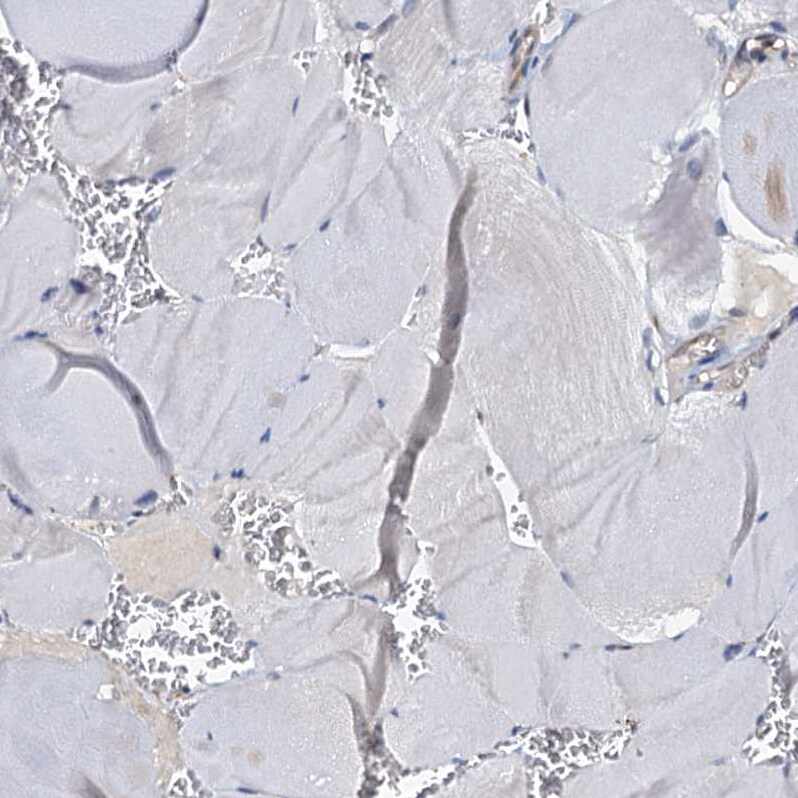 p23/PTGES3 Antibody - BSA Free Immunohistochemistry-Paraffin: p23/PTGES3 Antibody [NBP1-85485]