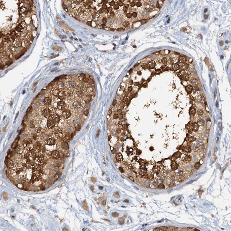 p23/PTGES3 Antibody - BSA Free Immunohistochemistry-Paraffin: p23/PTGES3 Antibody [NBP1-85485]