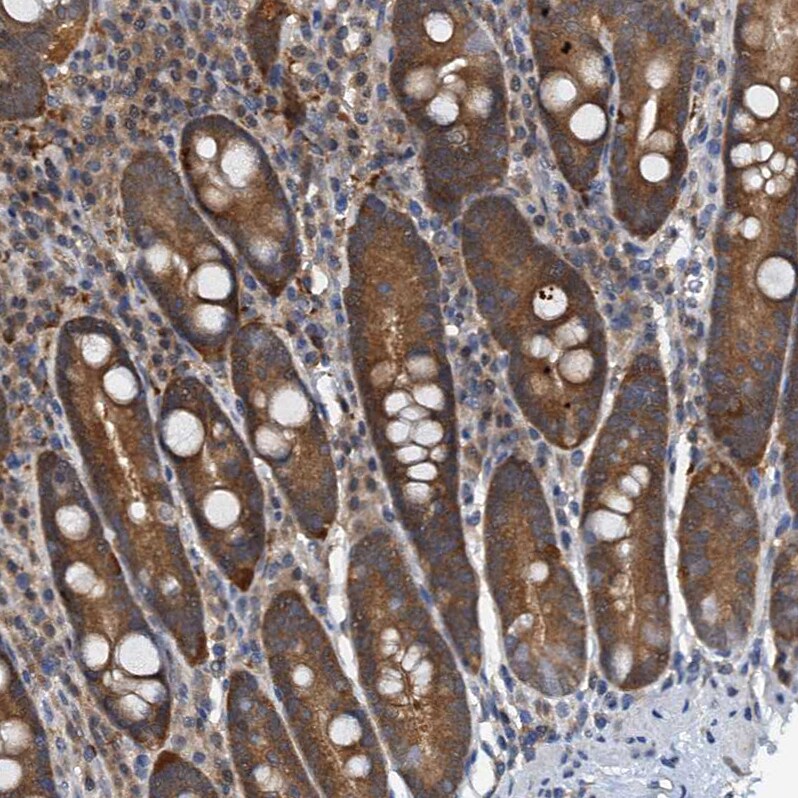 p23/PTGES3 Antibody - BSA Free Immunohistochemistry-Paraffin: p23/PTGES3 Antibody [NBP1-85485]