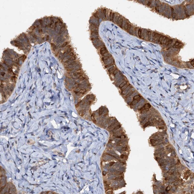 p23/PTGES3 Antibody - BSA Free Immunohistochemistry-Paraffin: p23/PTGES3 Antibody [NBP1-85485]