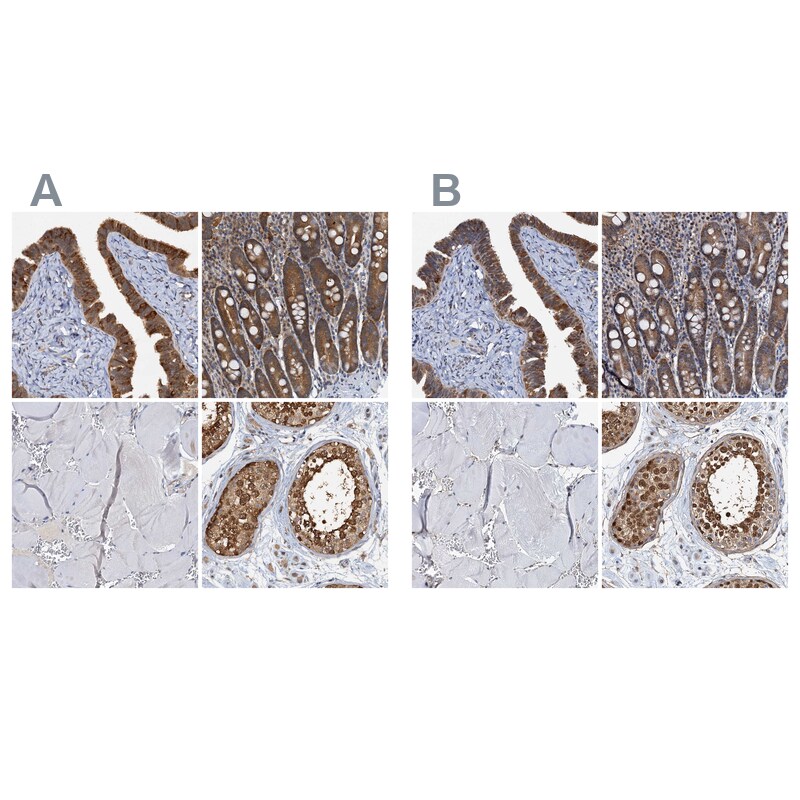 p23/PTGES3 Antibody - BSA Free Immunohistochemistry-Paraffin: p23/PTGES3 Antibody [NBP1-85485]
