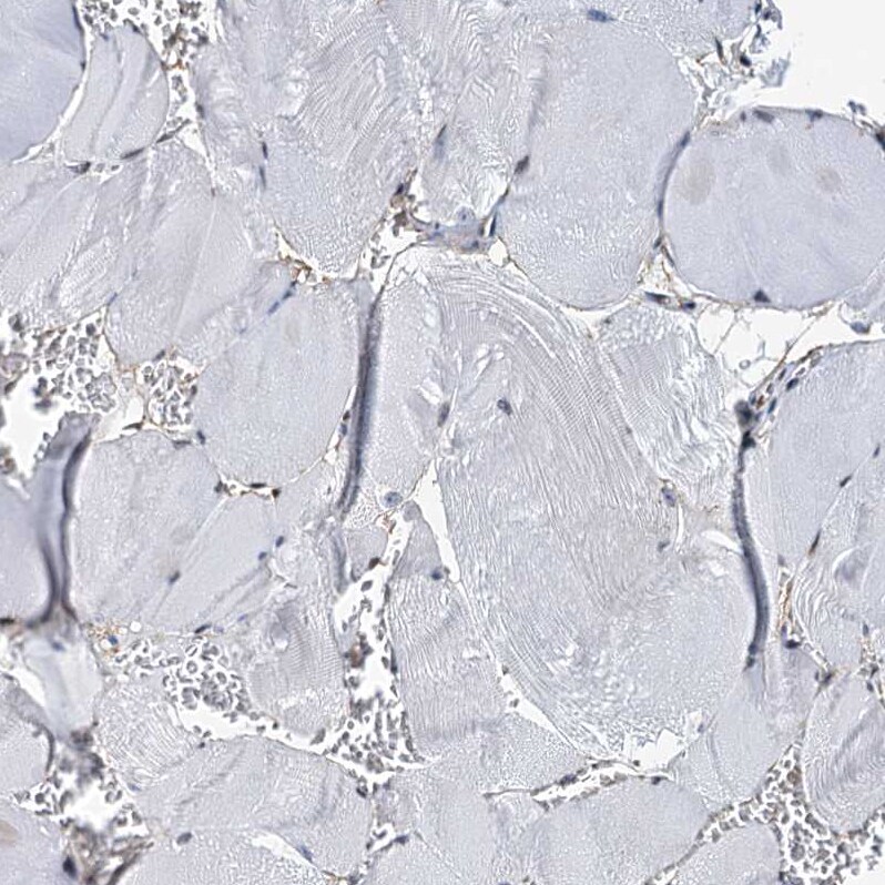 p23/PTGES3 Antibody - BSA Free Immunohistochemistry-Paraffin: p23/PTGES3 Antibody [NBP1-85486]