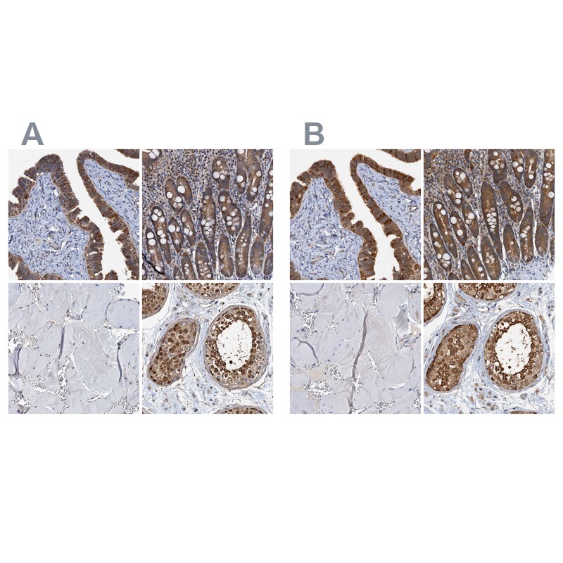 p23/PTGES3 Antibody - BSA Free Immunohistochemistry-Paraffin: p23/PTGES3 Antibody [NBP1-85486]