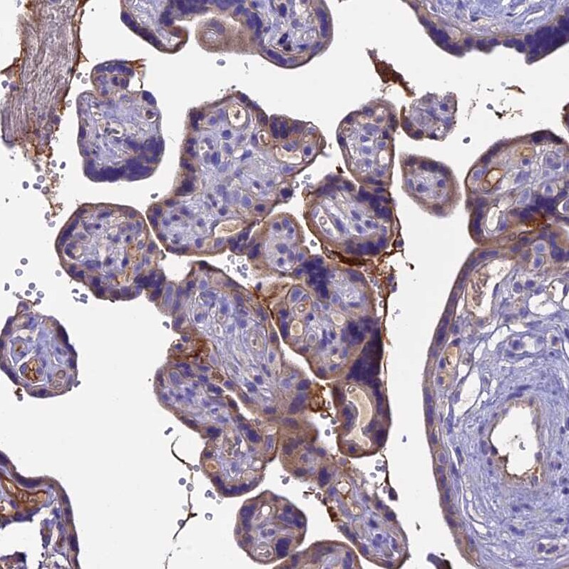 Pregnancy Zone Protein Antibody - BSA Free Immunohistochemistry: Pregnancy Zone Protein Antibody - BSA Free [NBP1-85490]