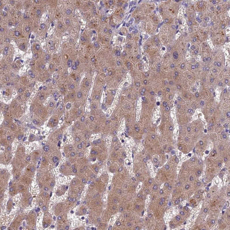 Pregnancy Zone Protein Antibody - BSA Free Immunohistochemistry: Pregnancy Zone Protein Antibody - BSA Free [NBP1-85490]