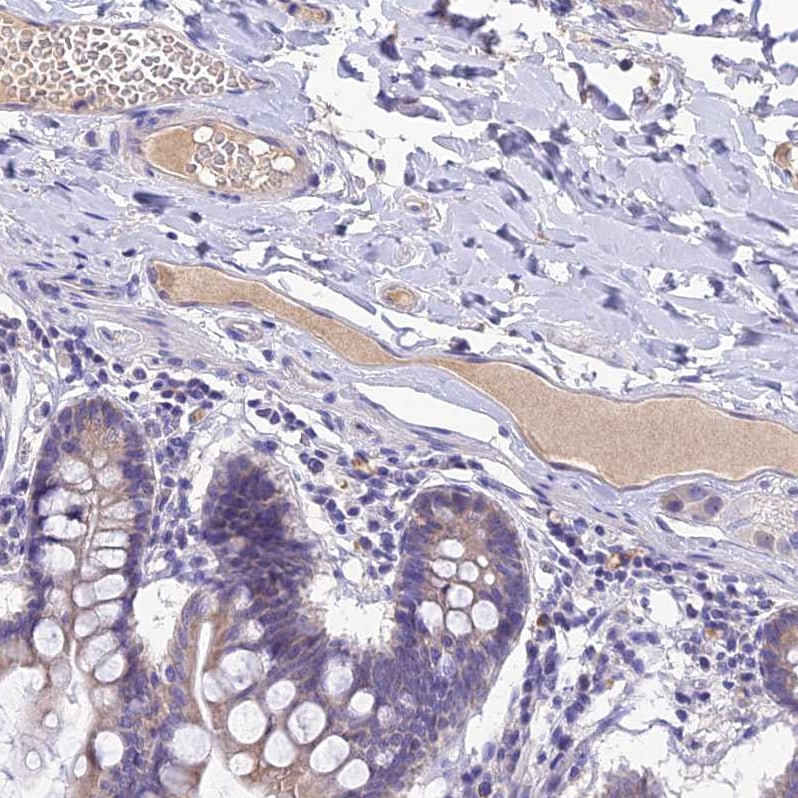 Pregnancy Zone Protein Antibody - BSA Free Immunohistochemistry: Pregnancy Zone Protein Antibody - BSA Free [NBP1-85490]