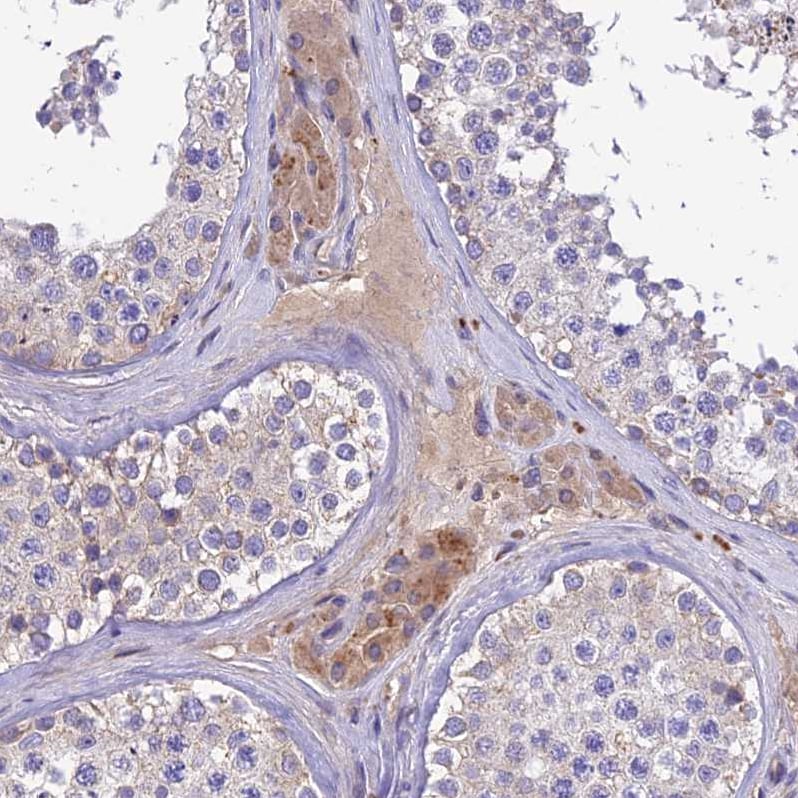Pregnancy Zone Protein Antibody - BSA Free Immunohistochemistry: Pregnancy Zone Protein Antibody - BSA Free [NBP1-85490]