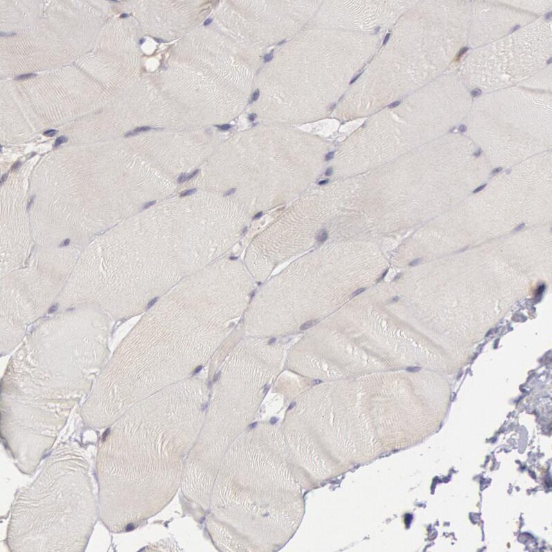 COX-2 Antibody - BSA Free Immunohistochemistry-Paraffin: COX-2 Antibody [NBP1-85499]