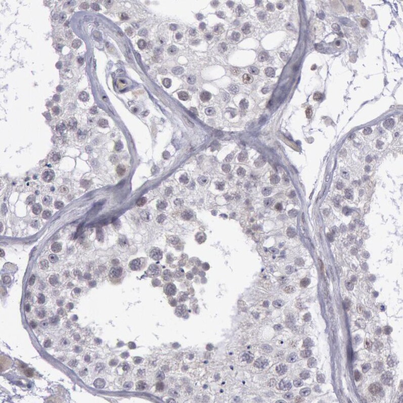COX-2 Antibody - BSA Free Immunohistochemistry-Paraffin: COX-2 Antibody [NBP1-85499]