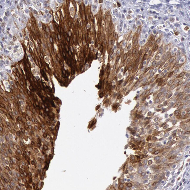 COX-2 Antibody - BSA Free Immunohistochemistry-Paraffin: COX-2 Antibody [NBP1-85499]